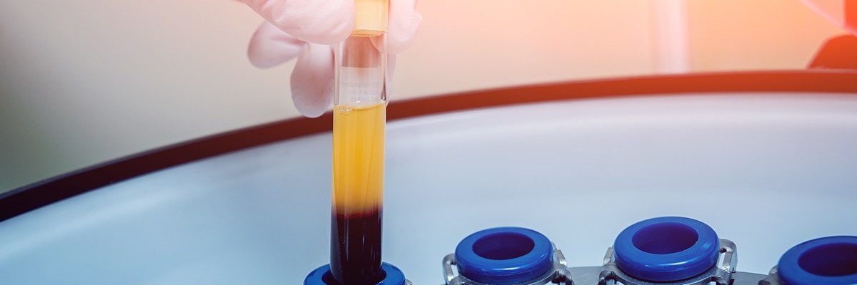 Lab technician using ElastoSens™ Bio for blood plasma coagulation analysis.